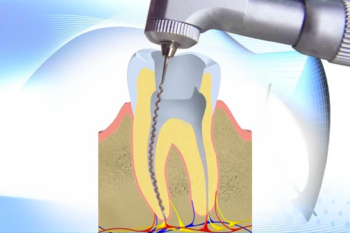 5.endodoncia5def